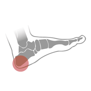 Your heel and your arch are more in sync than you realize. With our custom arch and hole-in-heel design, we support both your heel and your arch, and can help kickstart your biomechanics. 